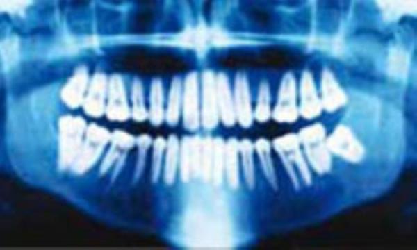 عکس دندان به چه دردی می خورد؟